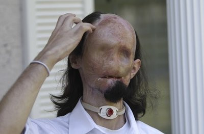 Tıp tarihinde bir ilk gerçekleştirildi! - Resim: 4