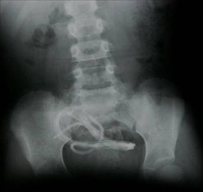 Bu ölümlerin hepsi şaka gibi - Resim: 1