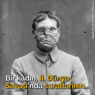 Yaptığı maskeler ile yüzünden yaralananları hayata bağladı - Resim: 1