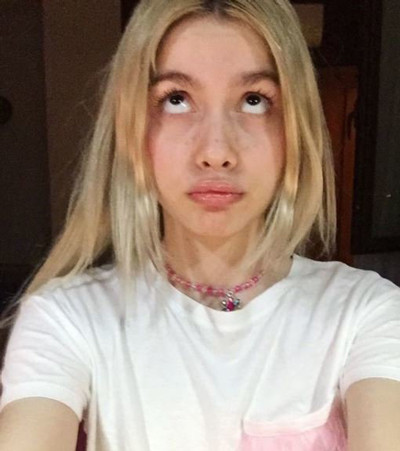 Aleyna Tilki dudaklarına dolgu mu yaptırdı işte yanıtı - Resim: 3