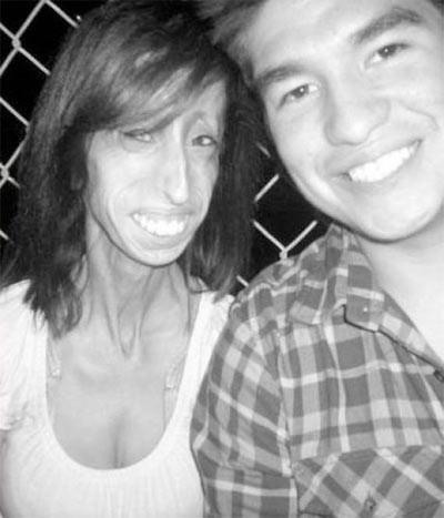 25 kiloluk kız dehşete düşürdü - Resim: 4