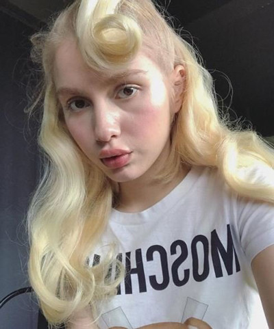 Aleyna Tilki dudaklarına dolgu mu yaptırdı işte yanıtı - Resim: 1