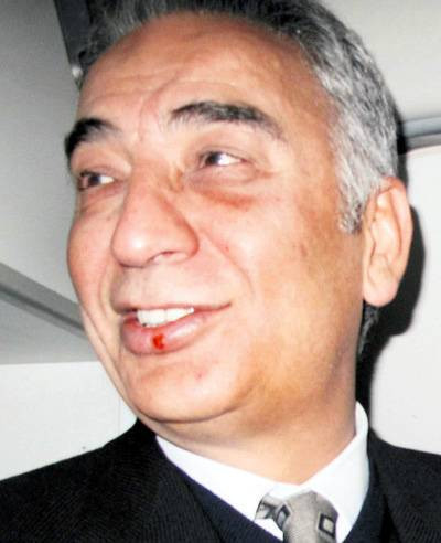 Polat'ın dudağı uçukladı - Resim: 4