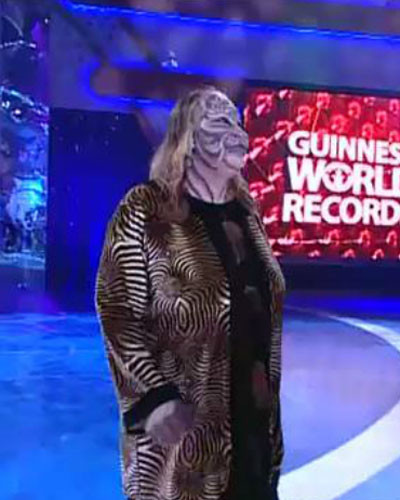 Ameliyatla kendini kaplana benzetti - Resim: 1