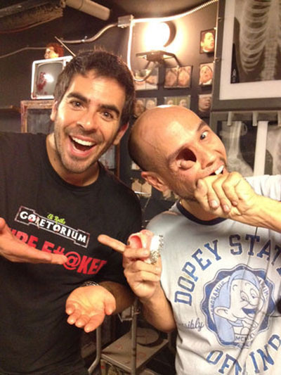 Bu adam yüzünün yarısı olmadan yaşıyor - Resim: 2