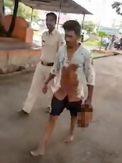 Yasak aşk dehşeti! Kesik başla 20 kilometre - Resim: 4