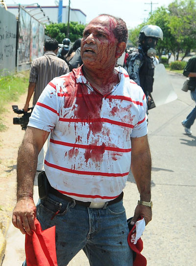 Güne damga vuran 50 sarsıcı kare! - Resim: 3