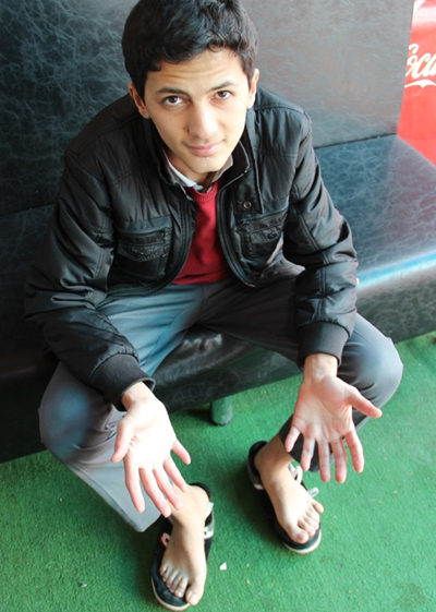 Onun tam 24 parmağı var! Görenler şaşkın - Resim: 3