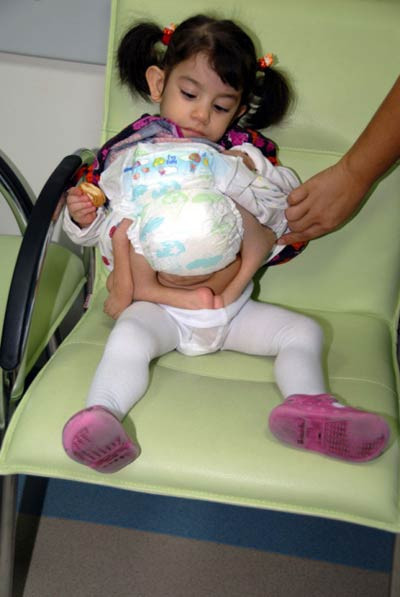 İkizini karnında taşıyor - Resim: 3