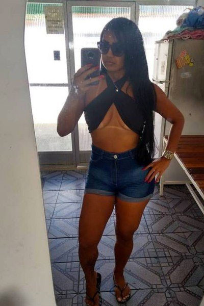 İş kadını kocasından gizli kalça büyütme ameliyatına girdi! Sonrası korkunç... - Resim: 3