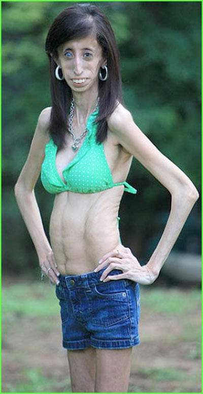 25 kiloluk kız dehşete düşürdü - Resim: 2