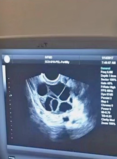 Eşine az rastlanır olay kendi rızasıyla torununu doğurdu - Resim: 1