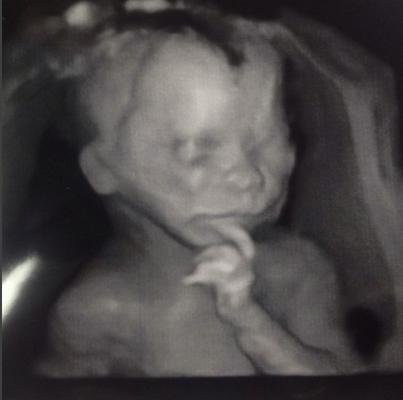 Bebeğin yanında bir de kedi bekliyorlar - Resim: 3