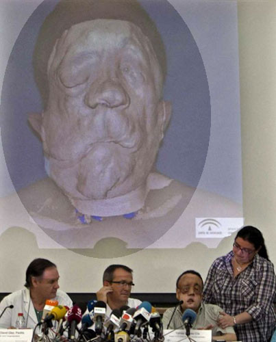 İlk kez insan içine çıktı! - Resim: 2