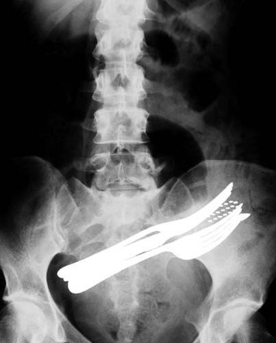 Bu röntgenler gerçek! - Resim: 1