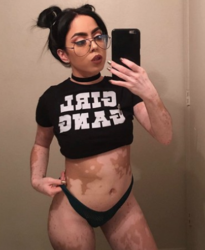 Görenler hayrete düşüyor! Hastalığını sanata çevirdi - Resim: 4