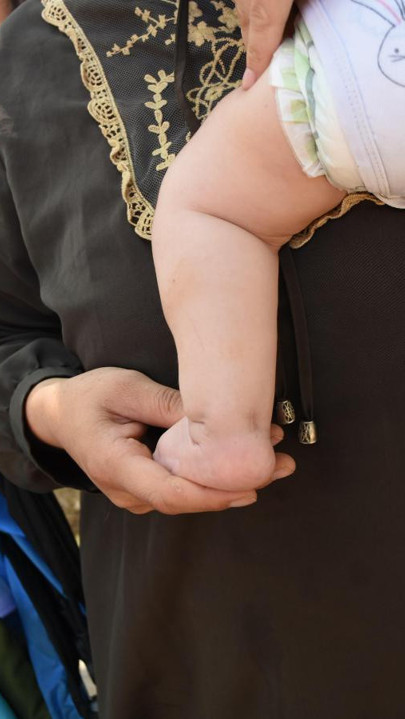 İzmir'de parkta kalan ailenin bebeklerinin medikal ayakkabısı çalındı - Resim: 0