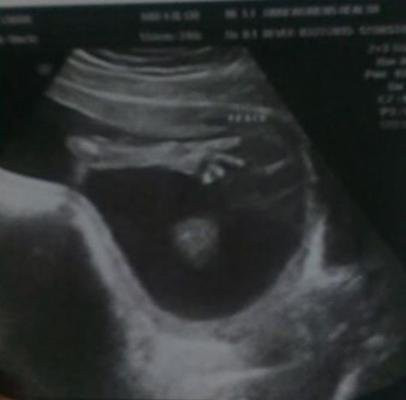 Bebeğin yanında bir de kedi bekliyorlar - Resim: 4