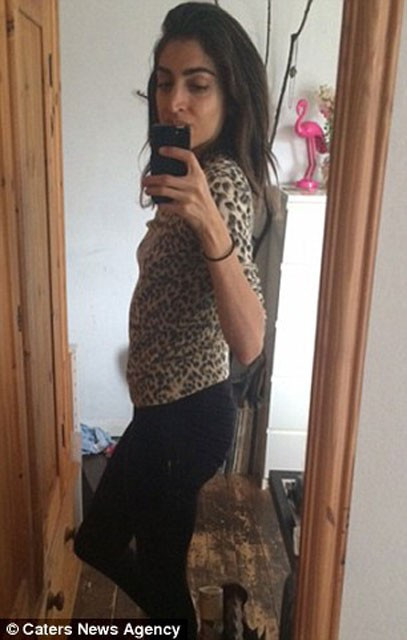 İnanılır gibi değil! 10 yıl boyunca bunu karnında taşımış - Resim: 3