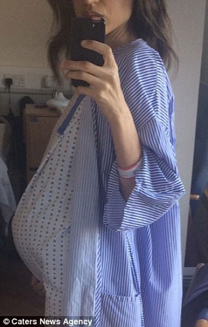 İnanılır gibi değil! 10 yıl boyunca bunu karnında taşımış - Resim: 4