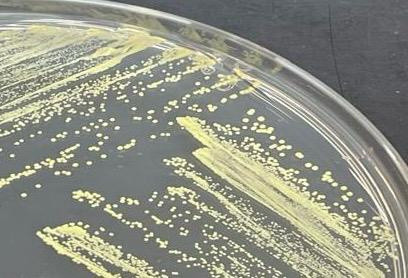 Bilim insanları uçak yakıtında yeni bir bakteri cinsi keşfetti - Resim: 0