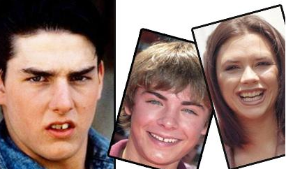 Ünlülerin eski dişlerine bakın! - Resim: 1