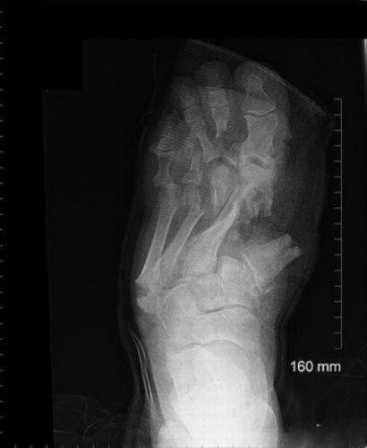Hayrete düşüren röntgen filmleri  - Resim: 2