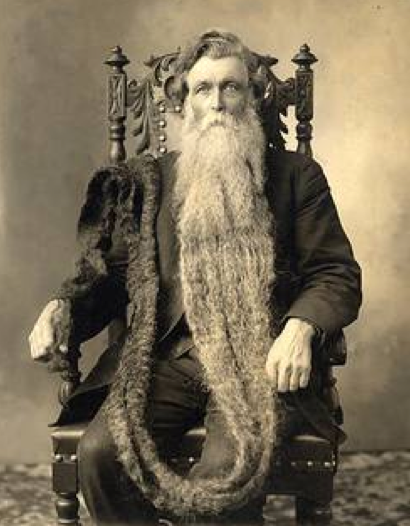 En ilginç 10 ölüm! - Resim: 3