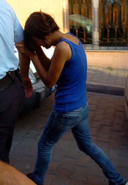 Küçük kızların sevgili kavgası kanlı bitti - Resim: 2