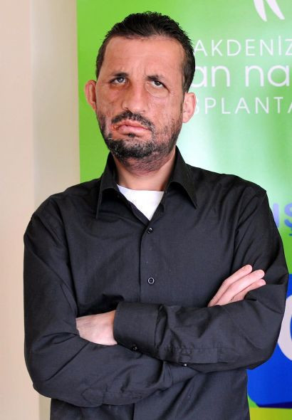 Türk tıp tarihi bu üçlüyü unutmayacak! - Resim: 4