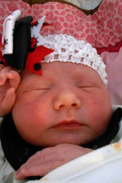 Küçük kızın dudağı morardı kanser çıktı... - Resim: 4