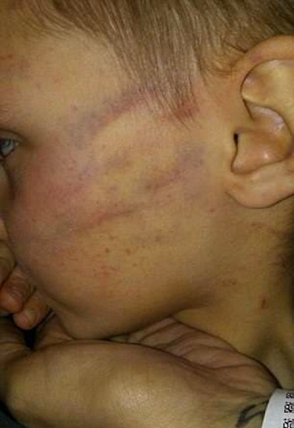 Sevgilisiyle oğlunu yalnız bıraktı eve döndüğünde oğlu yatağında bu haldeydi - Resim: 4