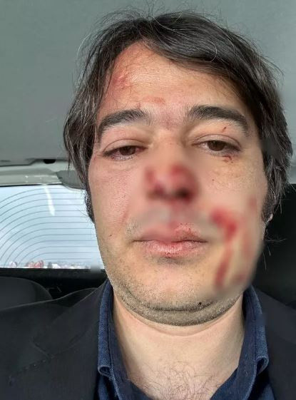 Üsküdar'da kaçak yapı yıkımında arbede! İBB imar müdürü hastanelik oldu - Resim: 0