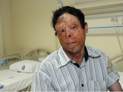 Nakilden sonra ilk kez basının karşısında - Resim: 2