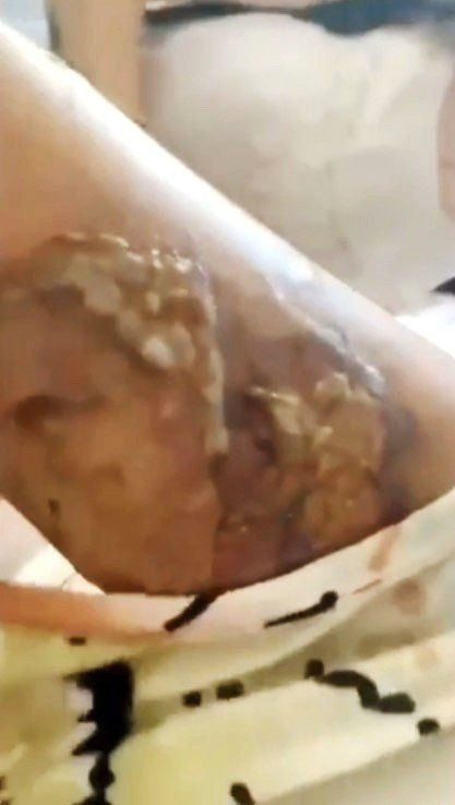 İstanbul'da kızgın bıçakla eşini yakıp zorla ilişkiye girdi! Anlattıkları kan dondurdu - Resim: 3