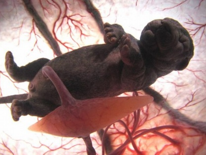 Anne karnından ilk görüntüler - Resim: 3