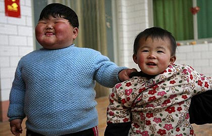 2 yaşında ama ya kilosu? - Resim: 2