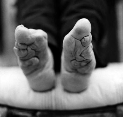 Bu işkenceyi güzelleşmek için çekiyorlar - Resim: 2