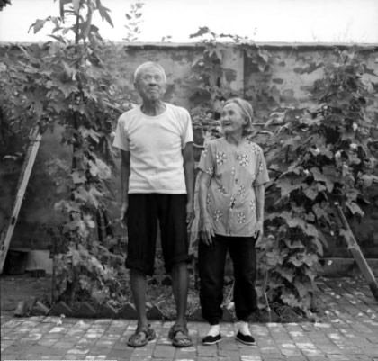 Bu işkenceyi güzelleşmek için çekiyorlar - Resim: 1