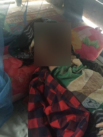 Diş çektirmeye gitti şimdi yüzünün yarısı yok! - Resim: 2