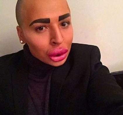 Kim Kardashian'a benzemek için servet harcadı sonuç... - Resim: 2