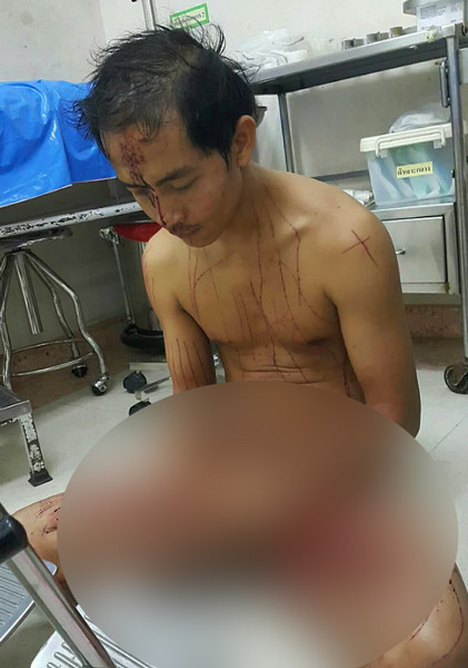 Cinsel içerikli görüntüler izlerken cinsel organını doğradı herkes şoke oldu - Resim: 4