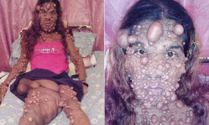 Görenler korkup kaçıyor canavar diye sesleniyorlar - Resim: 3