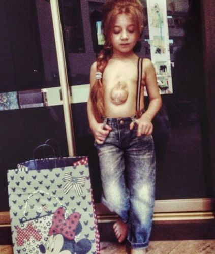 Kalbinin attığı yere bakın o mucize çocuk - Resim: 3