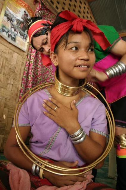 İşkence gibi güzellik anlayışı - Resim: 4