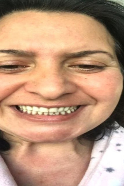 Delirten hastalık yüzünden Ötenazi istiyordu! Yüzü artık gülüyor - Resim: 0