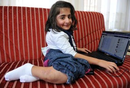 Kırılmasın diye tepsiyle taşınıyor - Resim: 3