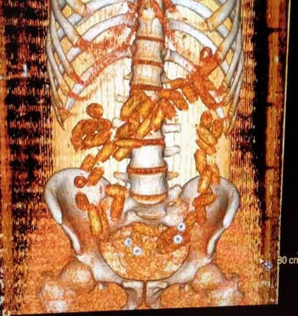 Havalimanında şoke eden görüntü! Kadın yolcunun... - Resim: 3