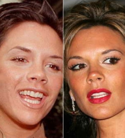 Ünlülerin dişleri şoke etti - Resim: 3