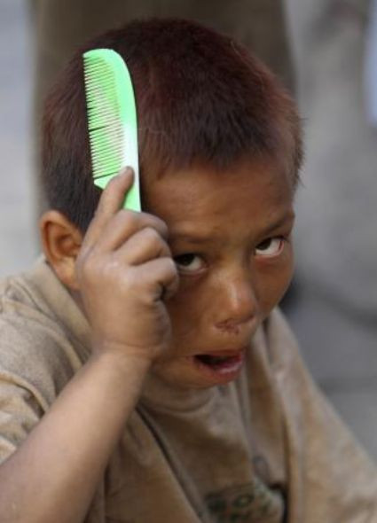 Haftanın tık rekoru kıran çılgın kareleri! - Resim: 1